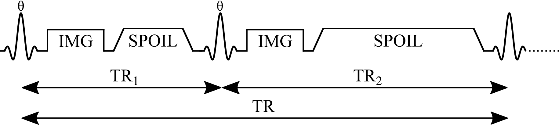 Simplified pulse sequence diagram of an actual flip-angle imaging (AFI) pulse sequence with a gradient echo readout. TR1: repetition time 1, TR2: repetition time 2, \theta: excitation flip angle for the measurement, IMG: image acquisition (k-space readout), SPOIL: spoiler gradient.