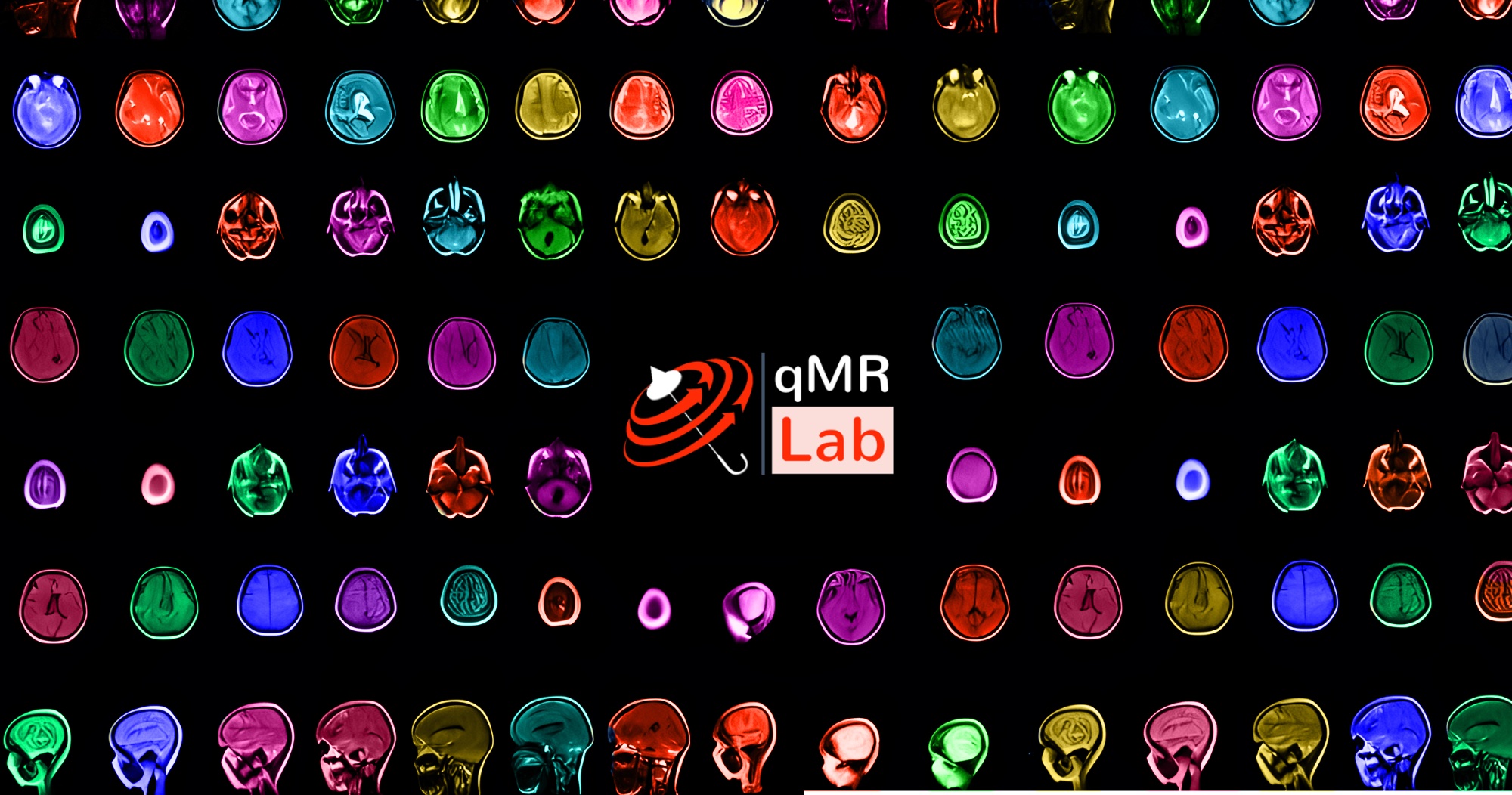 Quantitative vs conventional MRI