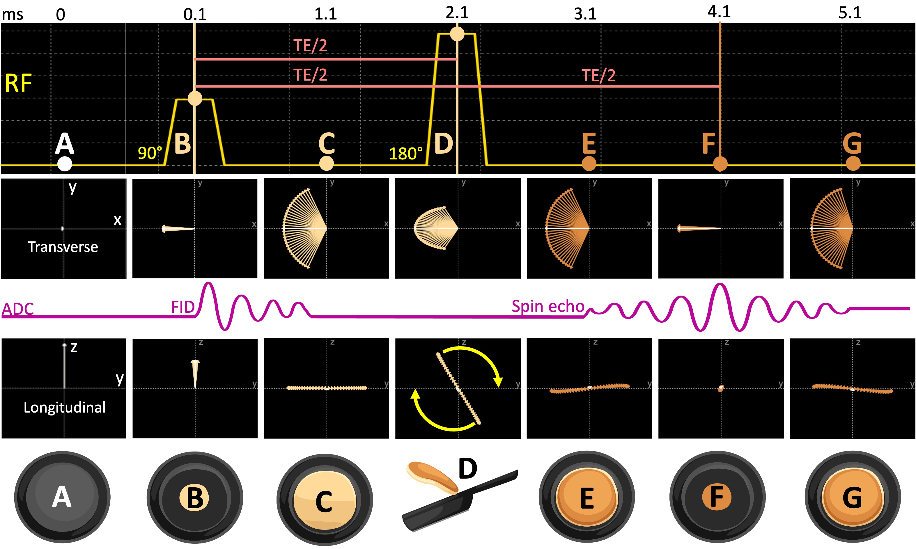 The spin evolution diagram of a spin-echo sequence is shown (A) before the excitation, (B) at the peak of the excitation pulse, (C) one millisecond after the 90°pulse, (D) at the peak of the refocusing pulse, (E) one millisecond after the 180°pulse, (F) at the echo time (TE) and (G) following the echo.