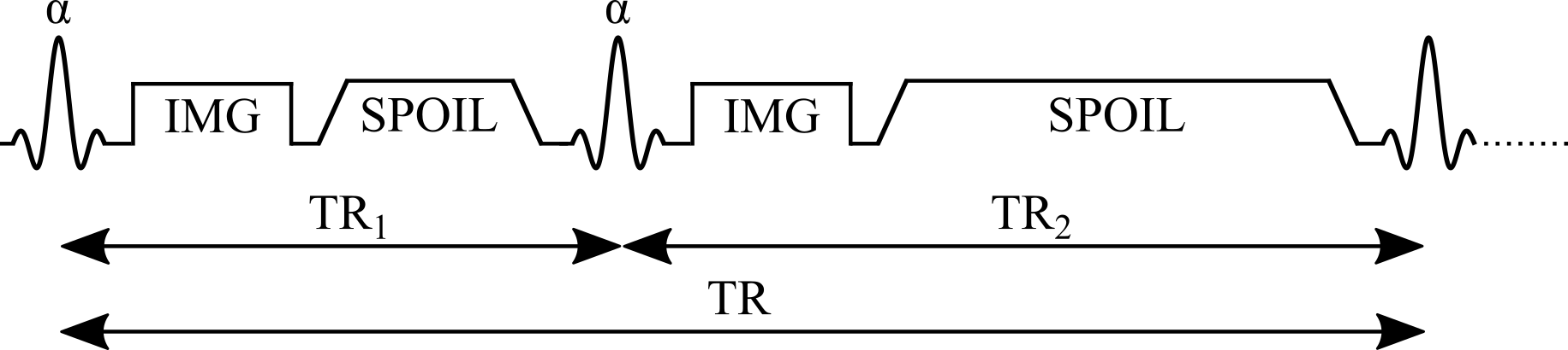 Simplified pulse sequence diagram of an actual flip-angle imaging (AFI) pulse sequence with a gradient echo readout. TR1: repetition time 1, TR2: repetition time 2, \theta: excitation flip angle for the measurement, IMG: image acquisition (k-space readout), SPOIL: spoiler gradient.