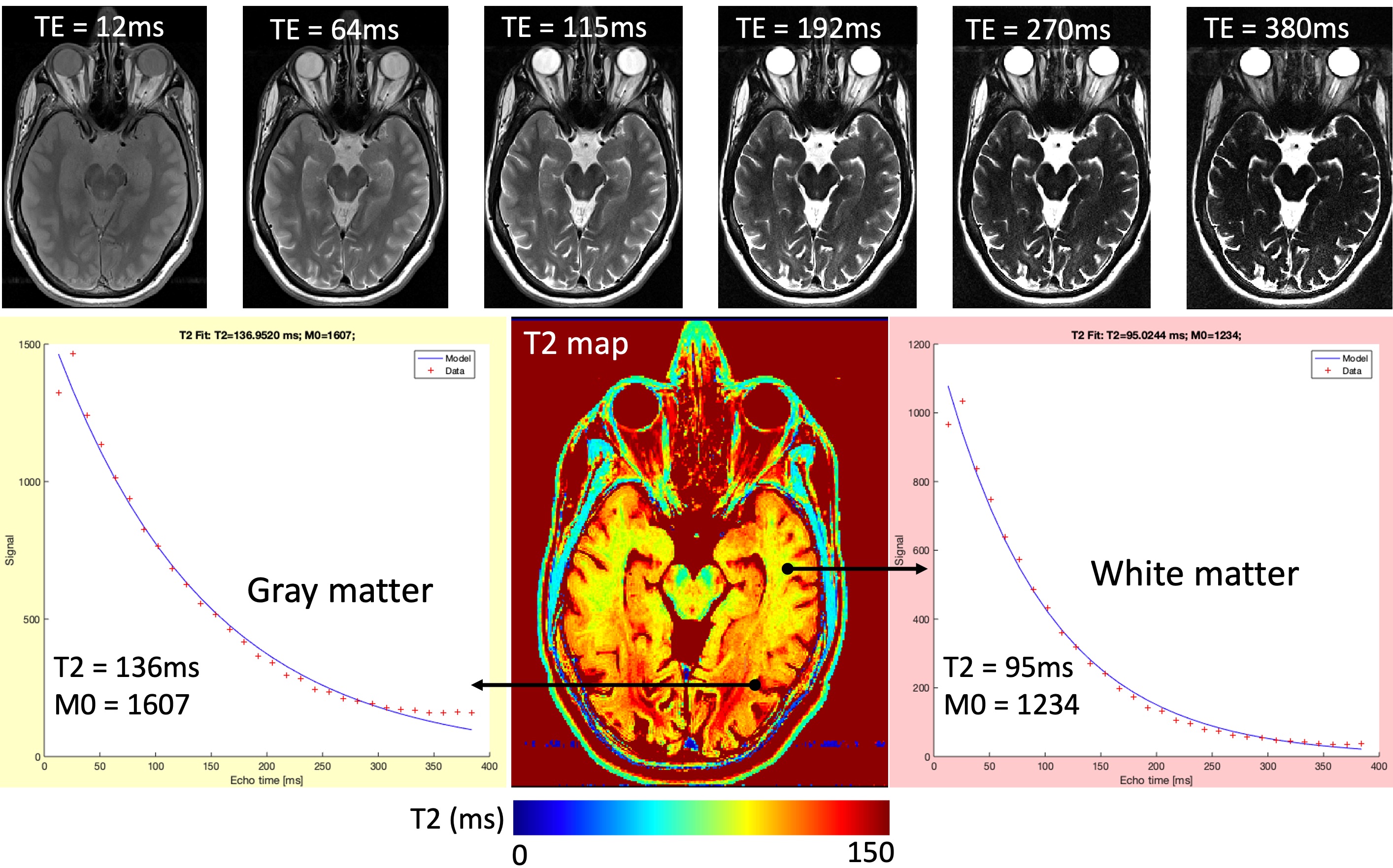 An example T2 map, estimated by fitting voxel-wise brightness values (red plus signs) across 32 echo times to the exponential decay (blue line) defined by Equation . The top row shows how conventional image contrast changes from proton-density to T2-weighted as the TE increases from 12ms to 380ms.