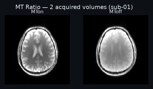 The 2 acquired volumes, each labeled with the identity the model reads it by.