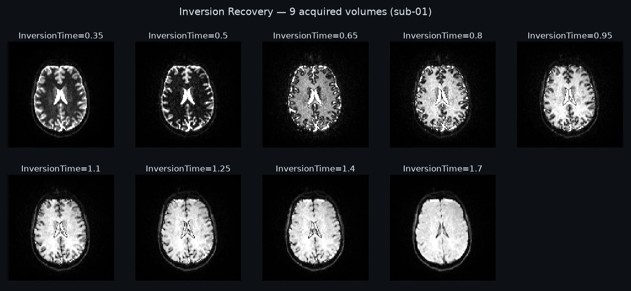 The 9 acquired volumes, each labeled with the identity the model reads it by.