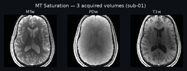 The 3 acquired volumes, each labeled with the identity the model reads it by.