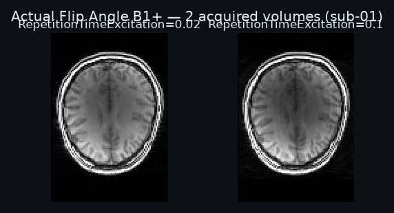 The 2 acquired volumes, each labeled with the identity the model reads it by.